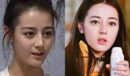 林志玲美白针爆料视频,揭秘明星美容秘籍背后的真相